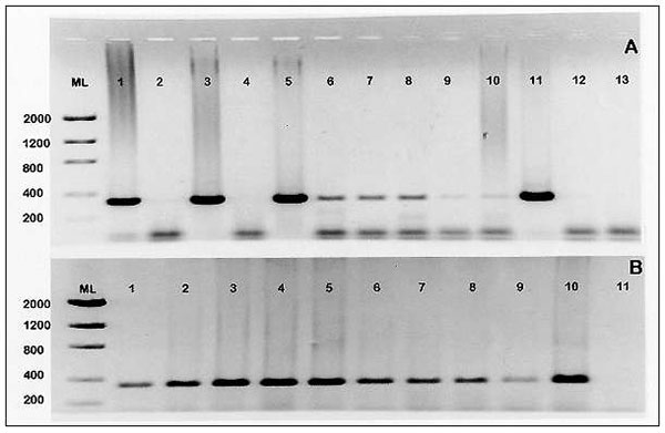 1,2 Panel A. Results of nested Cryptosporidium parvum CP 11 gene PCR performed on pooled oyster hemolymph and gill tissues. Expected PCR product size is 344 bp. Samples analyzed were collected from Maryland Department of Natural Resources oyster harvesting sites at Mt Vernon Wharf (lanes 1-5), Wetipquin (lanes 6-8), Beacon (lane 9), and Holland Point (lane 10). Lane 11: C. parvum positive control. Lanes 12 and 13 are 1° and 2° no template controls, respectively. Panel B: Results of oyster (Crass