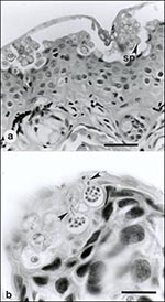 Thumbnail of . A: Ventral abdominal skin of Bufo haematiticus from western Panama. The superficial keratinized layer of epidermis (stratum corneum) contains numerous intracellular spherical-to-ovoid sporangia (spore-containing bodies) of Batrachochytrium sp. The mature sporangia (sp, arrows) are 12-20 µm (n = 25) in diameter and have refractile walls 0.5-2.0 µm thick. Most sporangia are empty, having discharged all zoospores, but a few sporangia contain two to nine zoospores. This stratum corneu