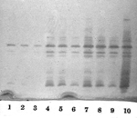 Thumbnail of Analytical isoelectric focusing (IEF) of serially diluted broth induced enzymes. The isoelectric points (pIs) of the two prominent bands midway and at the bottom of the gel are 6.9 and &gt;9.0. Lanes 1–3: uninduced enzyme serially diluted 1:1, 1:2, and 1:4. Lanes 4–6: enzyme induced with 8 μg/mL of cefoxitin serially diluted 1:1, 1:2, and 1:4. Lanes 7–9: enzyme induced with 4 μg/mL of imipenem serially diluted 1:1, 1:2 and 1:4. Lane 10: NOR-1 control, induced with 16 μg/mL of cefoxi