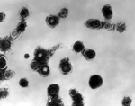 Thumbnail of Legend: Electron micrograph showing varicella zoster virus (VZV).