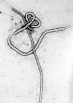 Thumbnail of Taken by Frederick Murphy at CDC, this iconic transmission electron micrograph shows the filamentous shape of the Ebola virus. On October 13, 1976, Murphy captured this image and, along with Karl Johnson and Patricia Webb, carried the printed negative, dripping wet, directly to CDC Director David Sencer. At the time, they were among the only persons in the world to have seen this “dark beauty” (F.A. Murphy, pers. comm.).