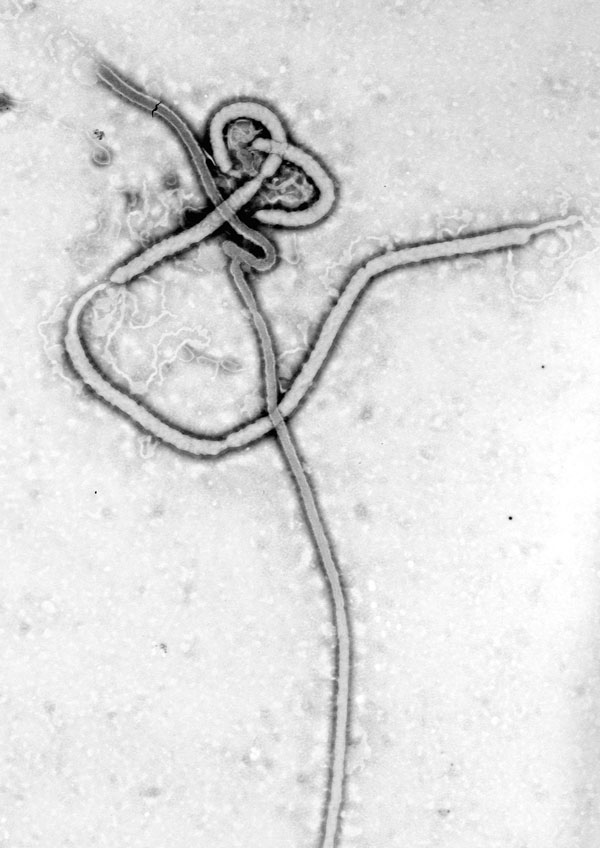 Taken by Frederick Murphy at CDC, this iconic transmission electron micrograph shows the filamentous shape of the Ebola virus. On October 13, 1976, Murphy captured this image and, along with Karl Johnson and Patricia Webb, carried the printed negative, dripping wet, directly to CDC Director David Sencer. At the time, they were among the only persons in the world to have seen this “dark beauty” (F.A. Murphy, pers. comm.).