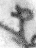 Thumbnail of Negative contrast electron microscopy of Marburg virus, from original monkey kidney cell culture propagation done at CDC in 1967, magnification ≈40,000x. Image courtesy of Frederick A. Murphy.