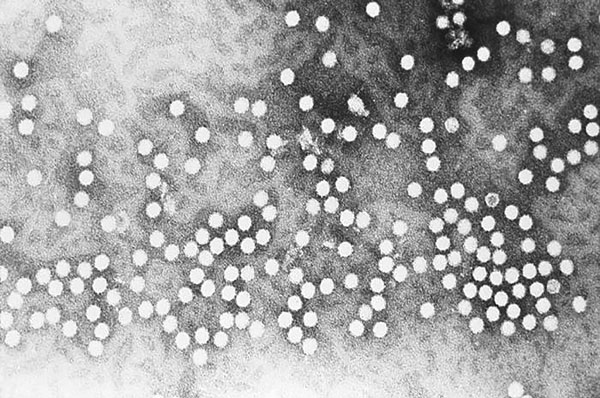 This electron micrograph depicts a number of parvovirus H-1 virions of the Parvoviridae family of DNA viruses. Photo CDC/ R. Regnery; E. L. Palmer, 1981.