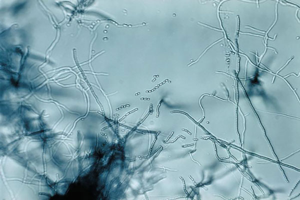 Slide culture of a Streptomyces sp. bacteria, which produces the antibiotic streptomycin. Note the branching filamentous hyphae, abundant aerial mycelia, and long chains of small spores. Image: CDC/Dr. David Berd