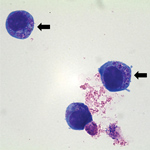 Thumbnail of Anaplasma phagocytophilum cultured in human promyelocytic cells, showing morulae as basophilic and intracytoplasmic inclusions (arrows). Wright-Giemsa stain. Original magnification x1,000. Image: Emerg Infect Dis. 2014;20:1708–11.