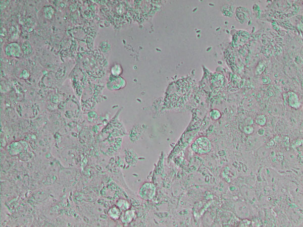 Neospora caninum, a coccidian parasite, which identified as a species in 1988. It is a major cause of spontaneous abortion in infected livestock.Image from WIkipedia.