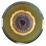 Thumbnail of Petri dish culture of a colony of the fungus Sporothrix schenckii strain M-36-53. This fungus is the cause of sporotrichosis. Centers for Disease Control and Production, Dr. Lucille K. Georg, 1964.