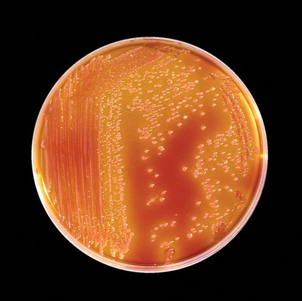 Culture plate containing the bacterium Serratia marcescens. The colonies are red because of a pigment (prodigiosin) produced by this organism. Centers for Disease Control and Prevention, 1985.