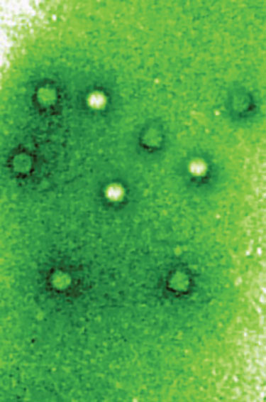 Picobirnavirus by negative stain electron microscopy, from Wikipedia, https://en.wikipedia.org/wiki/File:Picobirnavirus.jpg