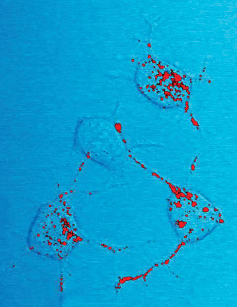 This photomicrograph of a neural tissue specimen, harvested from a scrapie affected mouse, revealed the presence of prion protein stained in red, which was in the process of being trafficked between neurons, by way of their interneuronal connections, known as neurites. Prion proteins can become infectious, causing neurodegenerative diseases such as transmissible spongiform encephalopathies (TSEs), which includes bovine spongiform encephalopathy (BSE), more commonly referred to a mad cow disease.