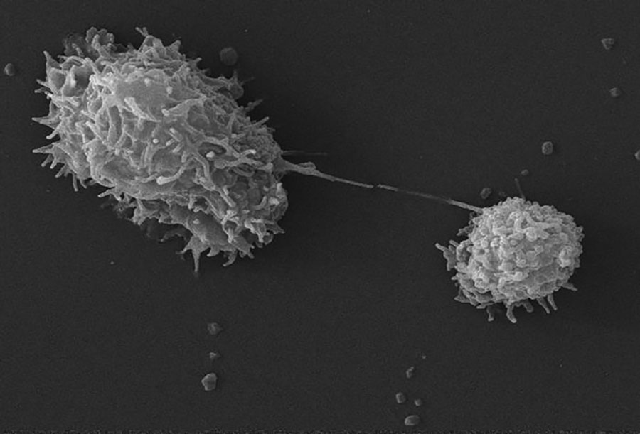 This scanning electron microscopic (SEM) image revealed an Acanthamoeba polyphaga protozoa; as it was about to complete the process of cell division; known as mitosis; thereby; becoming two distinct organisms. Note the numerous pseudopodia; projecting from the surfaces of these organisms. These pseudopodia enable the amoebae to move about; and grasp objects in their environment. CDC/ Catherine Armbruster, Margaret William; photo, Janice Haney Carr 2009