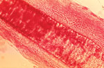 Thumbnail of Under a magnification of 430×, this photomicrograph of a guinea pig hair shaft specimen revealed ultrastructural features exhibited at the site of a ringworm infection by the dermatophyte, Trichophyton mentagrophytes. Note that the sporangia were confined to the outer region of the hair shaft, known as an exothrix infection. CDC/ Dr. Lucille K. Georg, 1968