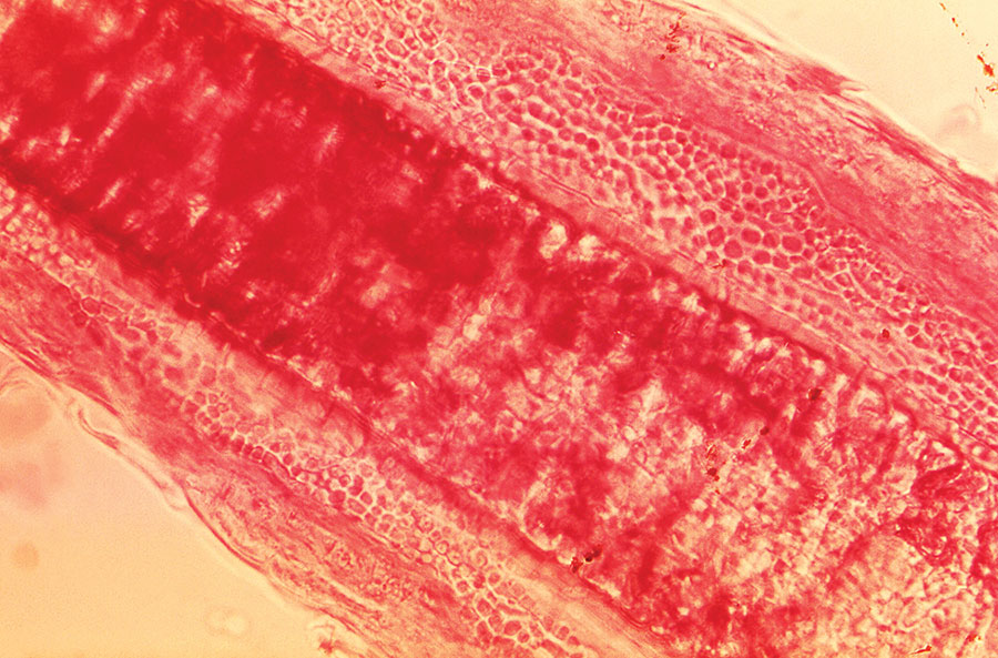 Under a magnification of 430×, this photomicrograph of a guinea pig hair shaft specimen revealed ultrastructural features exhibited at the site of a ringworm infection by the dermatophyte, Trichophyton mentagrophytes. Note that the sporangia were confined to the outer region of the hair shaft, known as an exothrix infection. CDC/ Dr. Lucille K. Georg, 1968