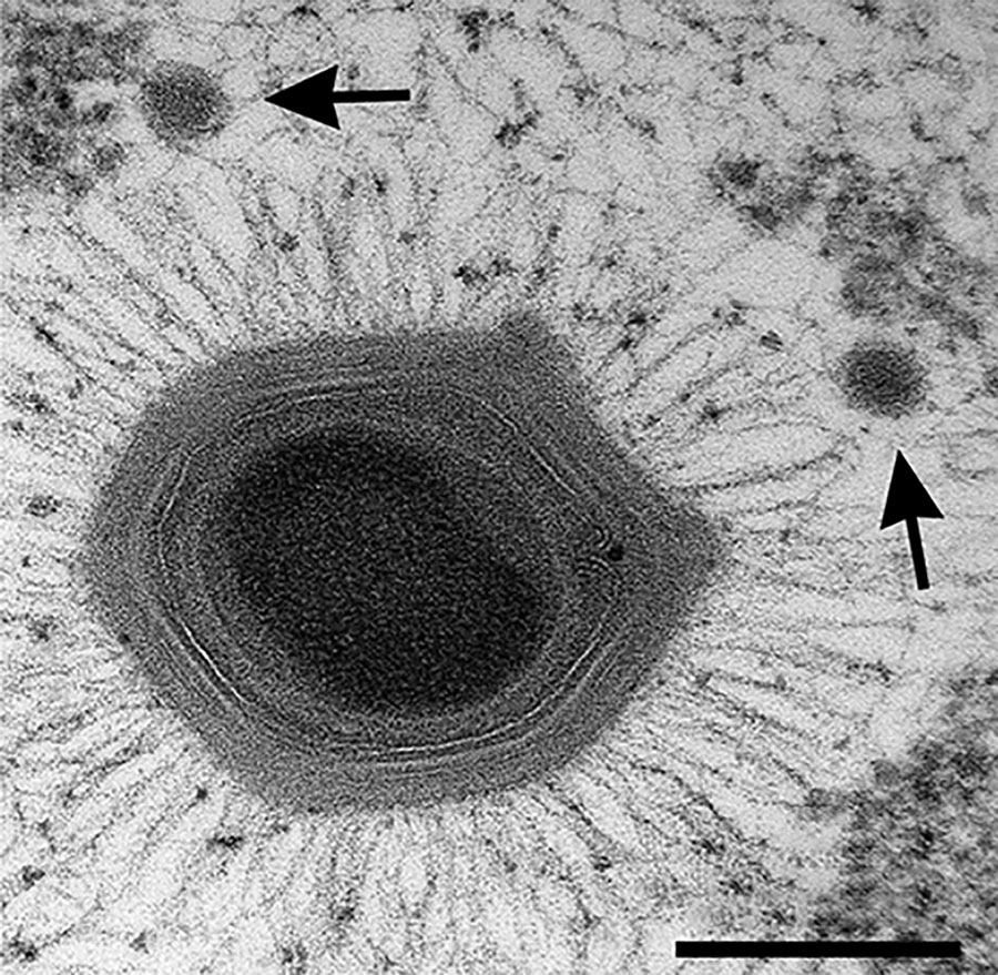 Mimivirus, Acanthamoeba polyphaga mimivirus, with two satellite Sputnik virophages (arrows) Thin-section electron microscopy courtesy of J.Y. Bou Khalil and B. La Scola, IHU Mediterranée Infection, France.