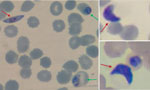 Giemsa-stained thin blood smear of Plasmodium falciparum (original magnification ×1,000). Red arrows indicate gametocytes, and green arrows indicate trophozoite stages. Photograph provided by A. Tiwari.